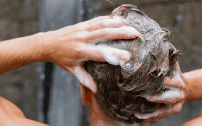 Best Anti Dandruff Shampoos