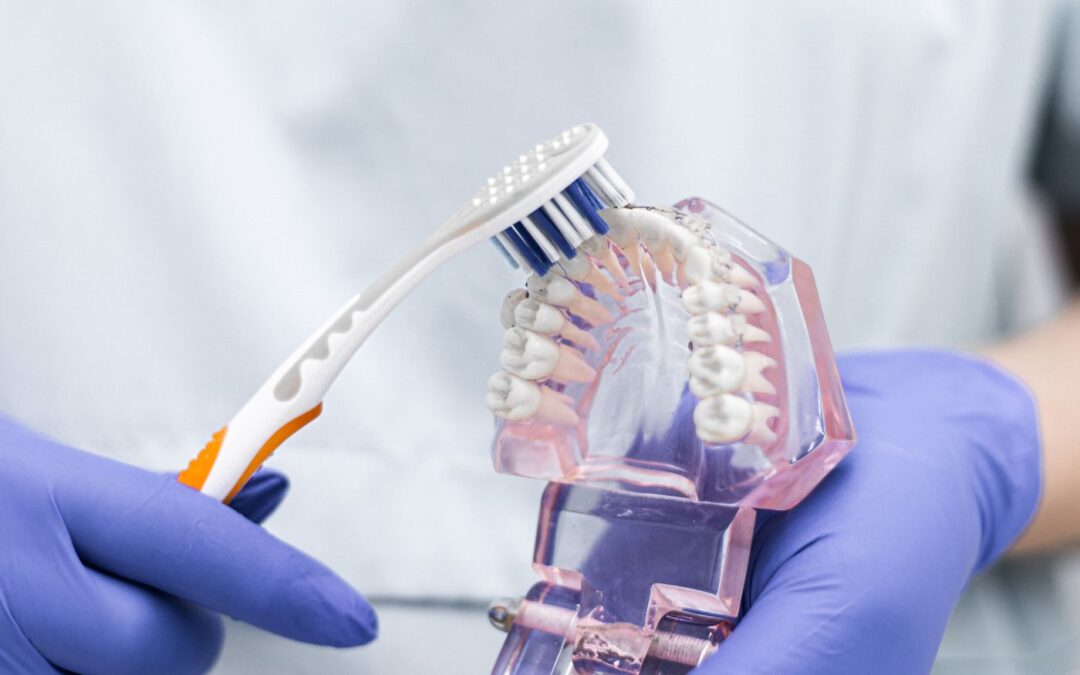 A gloved hand brushing a clear dental appliance model with a toothbrush
